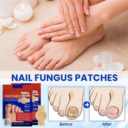 Curotron - Fungal Nail Renewal Patches