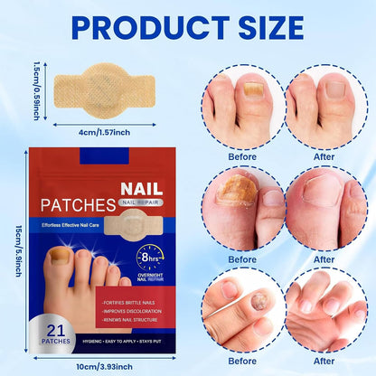 Curotron - Fungal Nail Renewal Patches